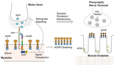 Muscle-Specific Kinase Myasthenia Gravis